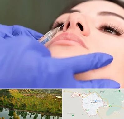 هیالاز در بهبهان