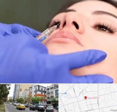 هیالاز در هفده شهریور تبریز