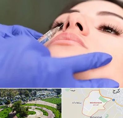 هیالاز در مهرشهر کرج 