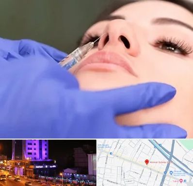 هیالاز در آبرسان تبریز