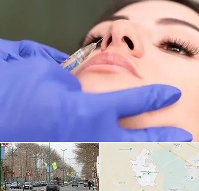 هیالاز در نظرآباد کرج