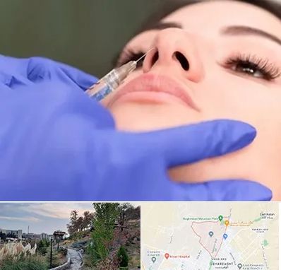 هیالاز در باغستان کرج