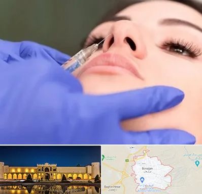 هیالاز در برازجان