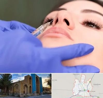 هیالاز در اهر