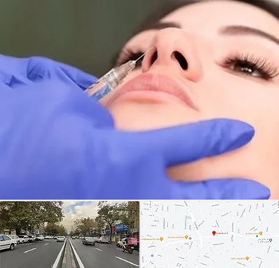 هیالاز در دولت