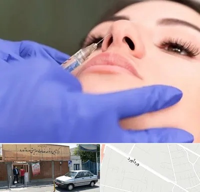 هیالاز در وردآورد