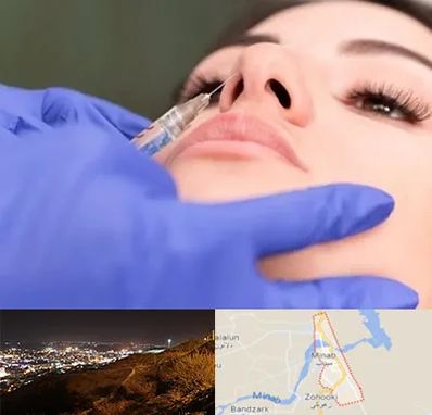 هیالاز در میناب