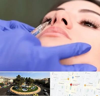 هیالاز در هفت حوض 