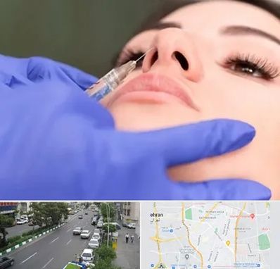 هیالاز در ستارخان 