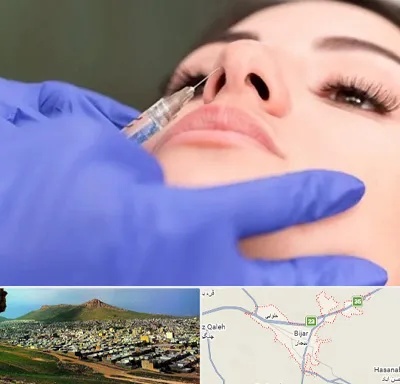 هیالاز در بیجار