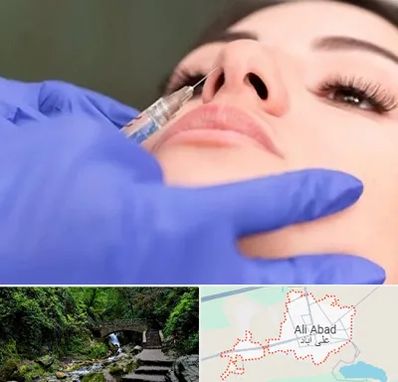 هیالاز در علی‌ آباد کتول