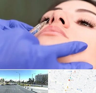 هیالاز در بلوار کلاهدوز مشهد