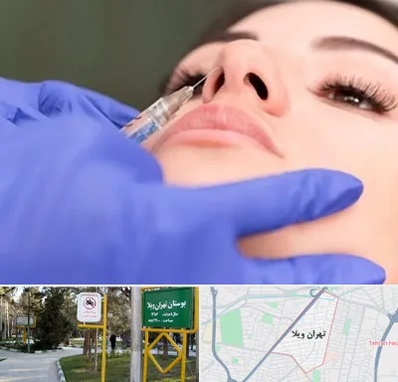 هیالاز در تهران ویلا