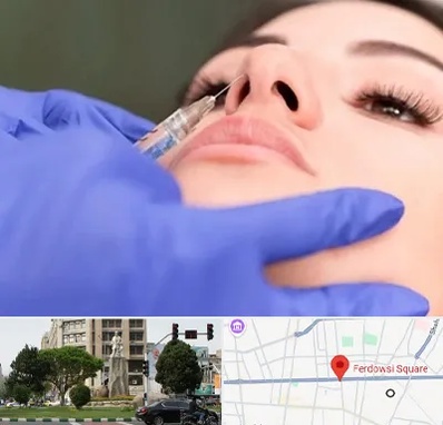 هیالاز در میدان فردوسی تهران