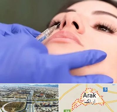 هیالاز در اراک