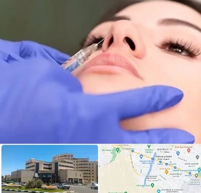 هیالاز در صیاد شیرازی مشهد