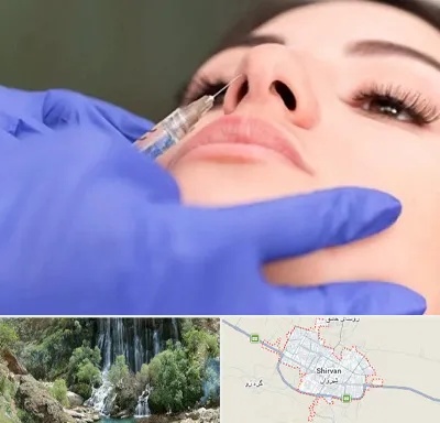 هیالاز در شیروان