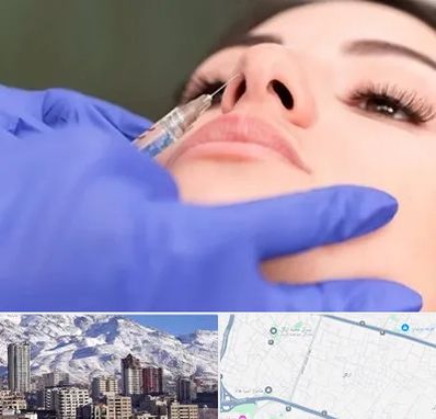 هیالاز در ازگل