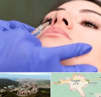 هیالاز در گرگان