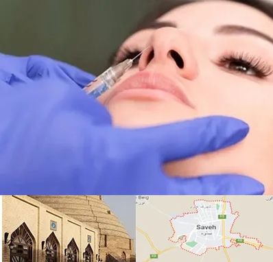 هیالاز در ساوه