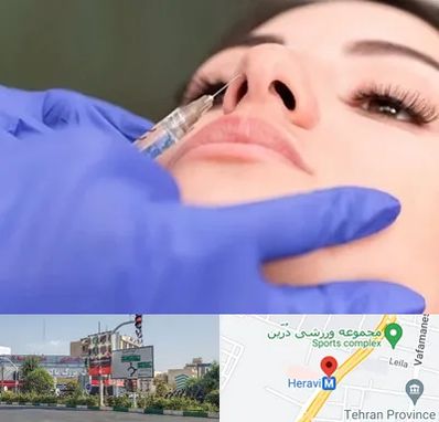 هیالاز در هروی 