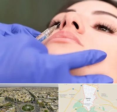 هیالاز در قزوین