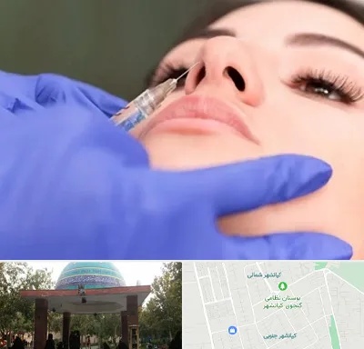 هیالاز در کیانشهر