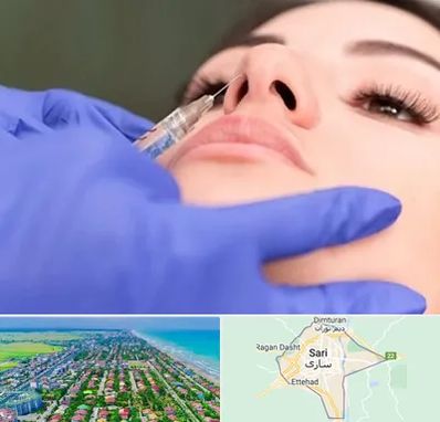 هیالاز در ساری