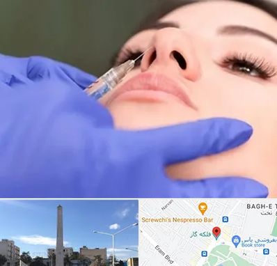 هیالاز در فلکه گاز شیراز