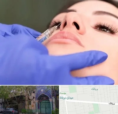 هیالاز در بریانک