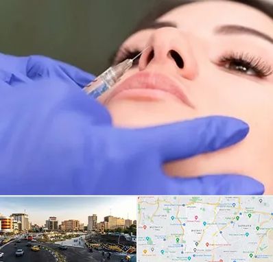 هیالاز در منطقه 7 تهران 