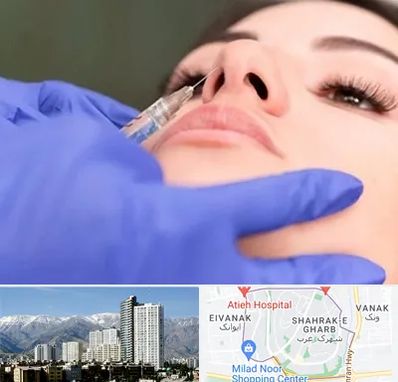 هیالاز در شهرک غرب 