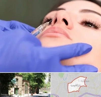 هیالاز در دزاشیب