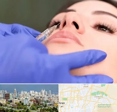 هیالاز در شرق تهران 