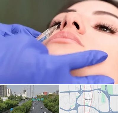 هیالاز در توانیر