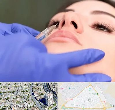 هیالاز در قاسم آباد مشهد 