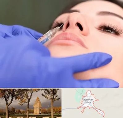 هیالاز در تویسرکان