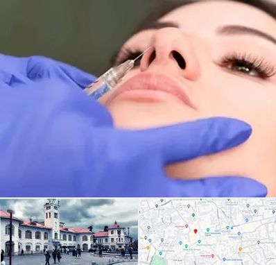 هیالاز در میدان شهرداری رشت