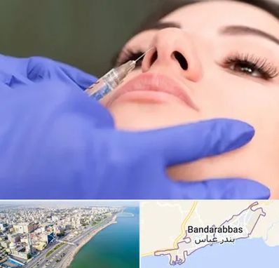 هیالاز در بندرعباس