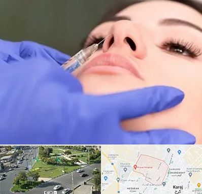 هیالاز در شاهین ویلا کرج