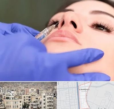 هیالاز در اسکندری