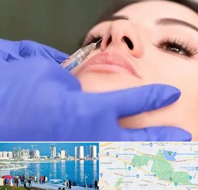 هیالاز در چیتگر 