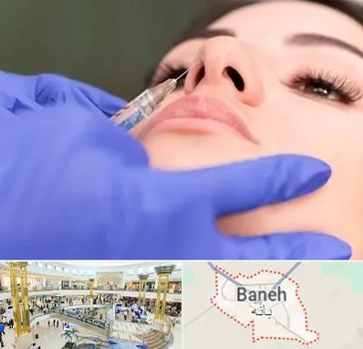 هیالاز در بانه