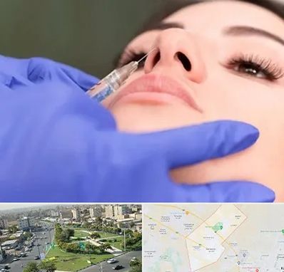 هیالاز در کمال شهر کرج