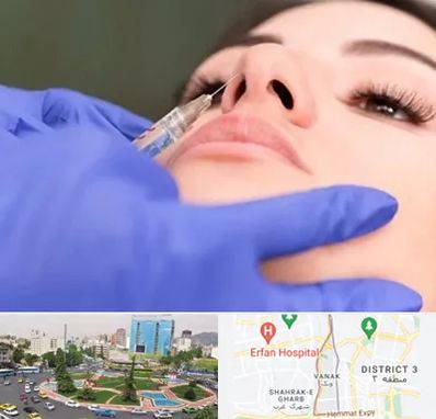 هیالاز در ونک 