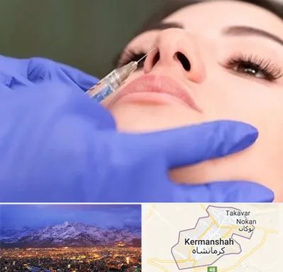 هیالاز در کرمانشاه