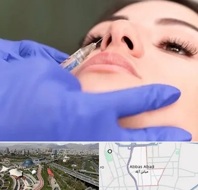 هیالاز در عباس آباد تهران