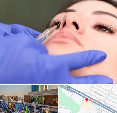 هیالاز در لاله پارک تبریز