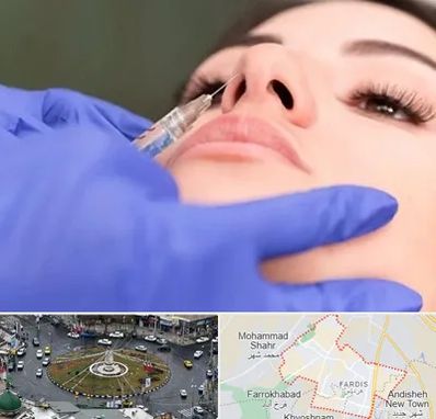 هیالاز در فردیس کرج 