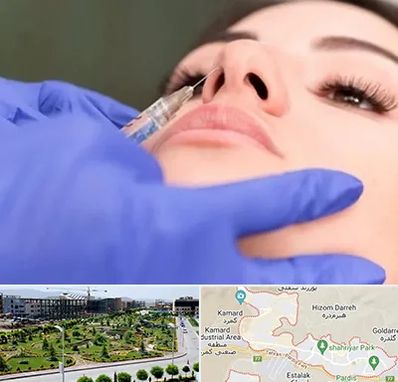 هیالاز در پردیس